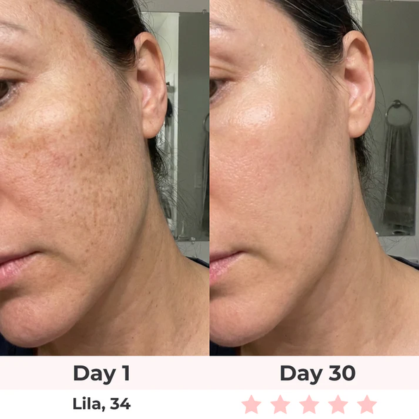 Avant après Sculpteur Facial LED - Lila 34 ans - Jour 1 vs Jour 30