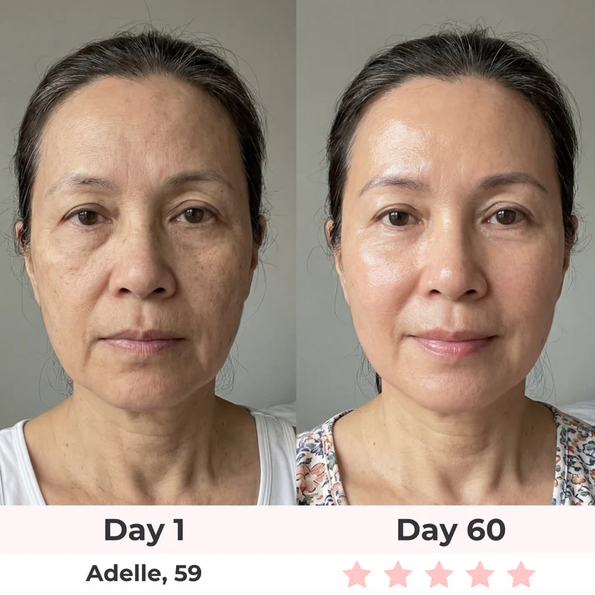 Comparaison masque LED vs clinique